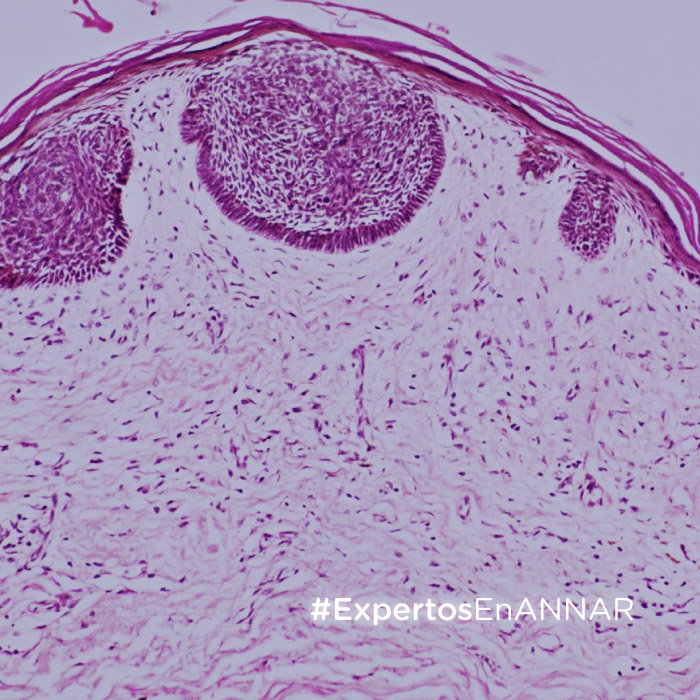 ANNAR-Miniatura-Diagnostica-Articulo-Plan-de-medios-Interpretación-del-PDL