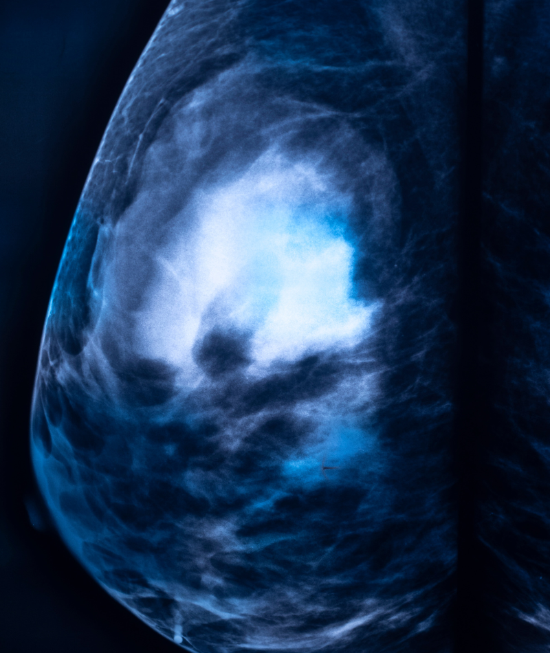 Oncología Clínica